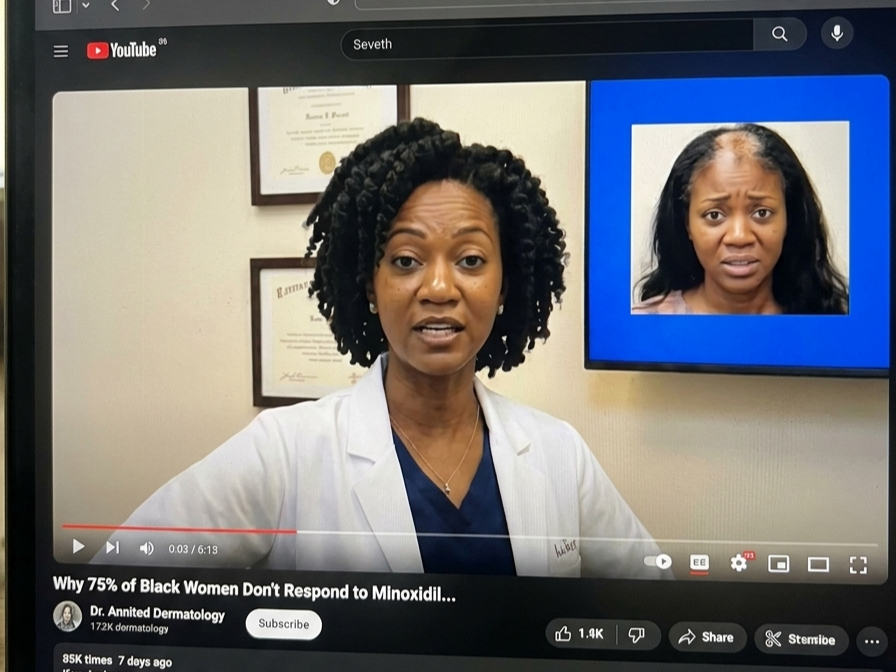 YouTube video of a Black dermatologist explaining why 75% of Black women don't respond to Minoxidil.